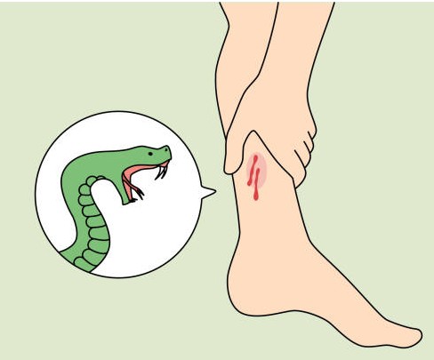 Qué hacer y qué NO hacer si te muerde una serpiente?